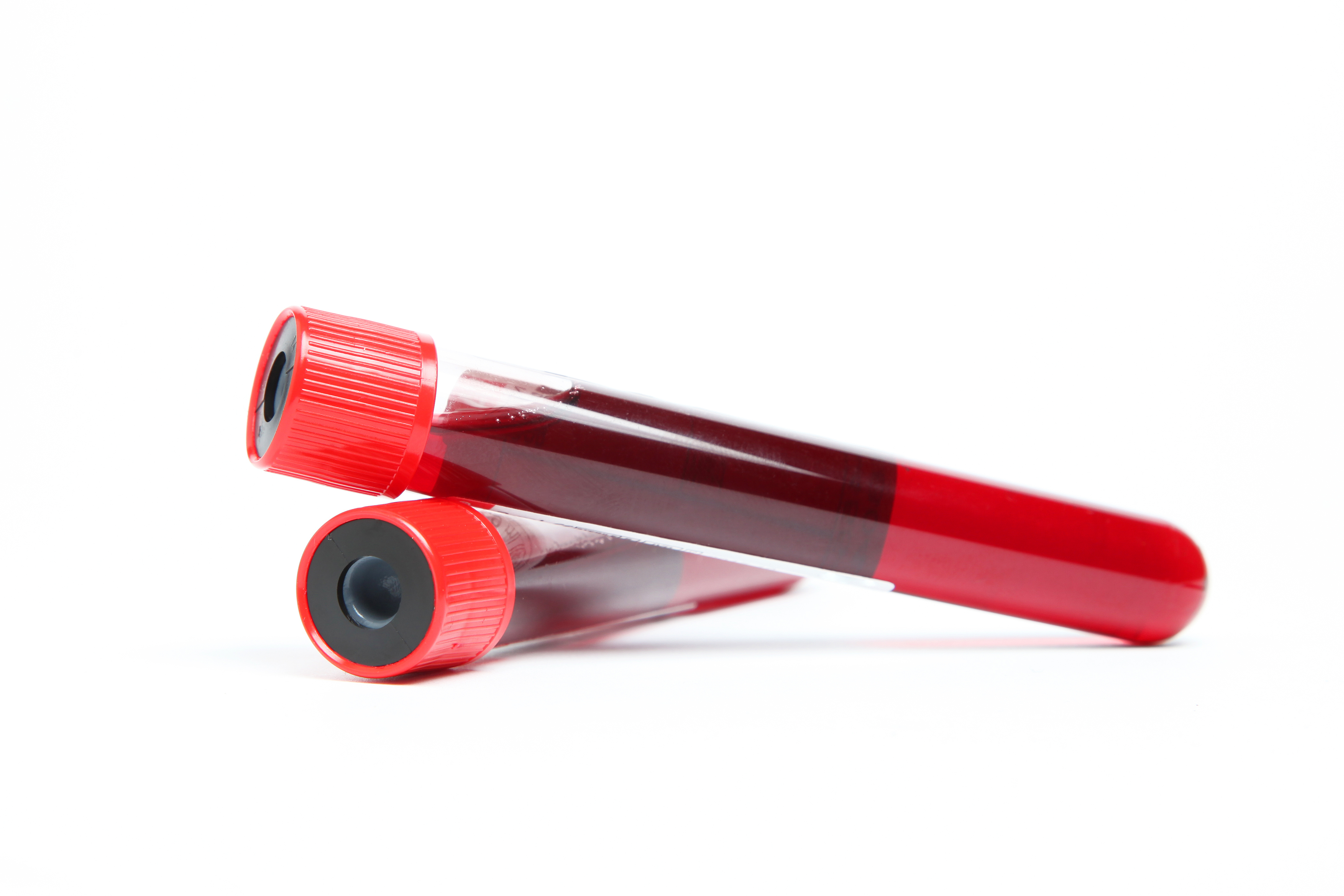 Vials of Blood Test for PSA