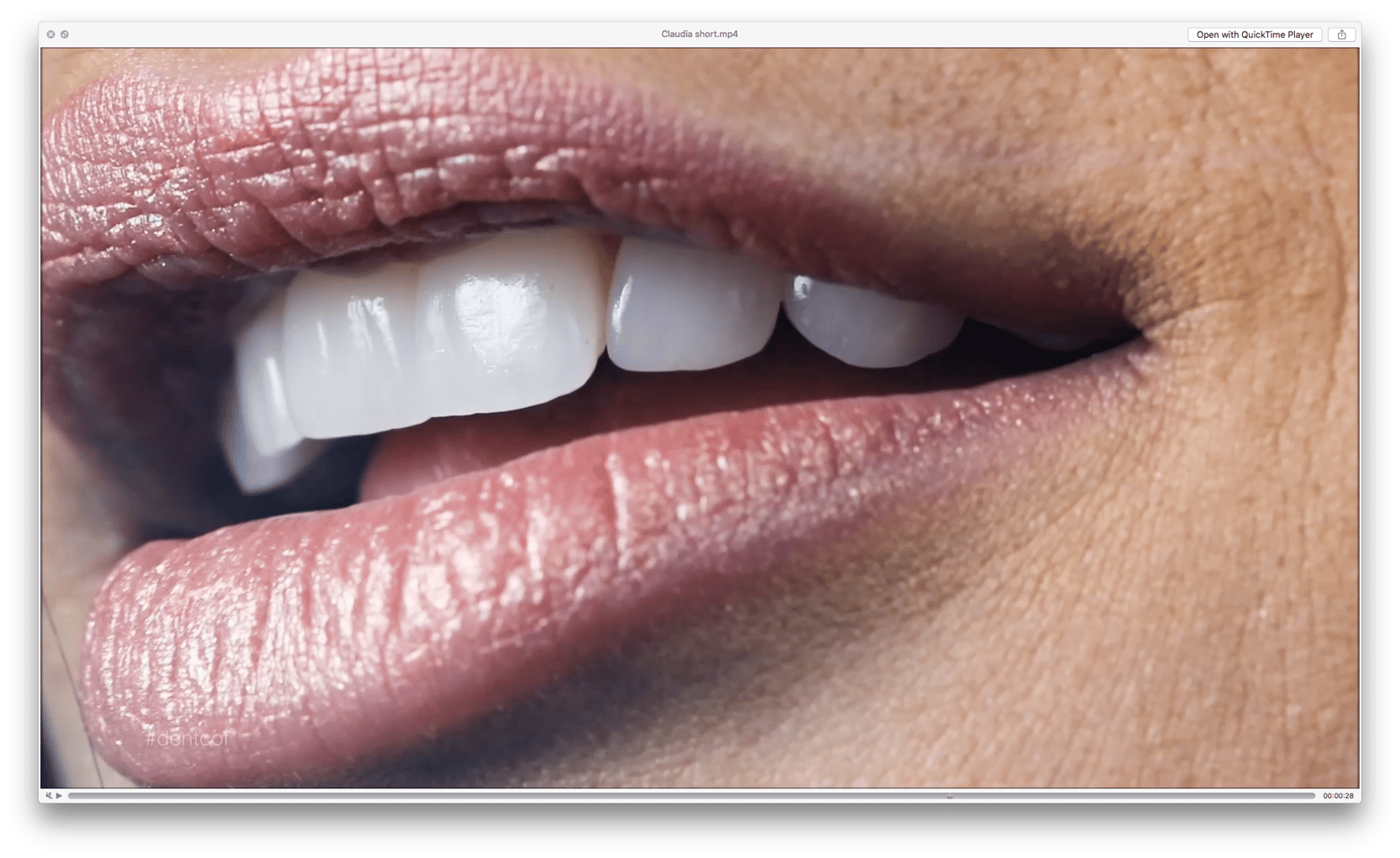 Digital Smile Design